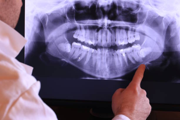 Best Emergency Dental Extractions in Greencastle, IN