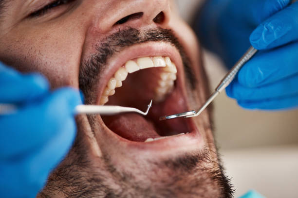 Best Weekend Emergency Dentist in Greencastle, IN