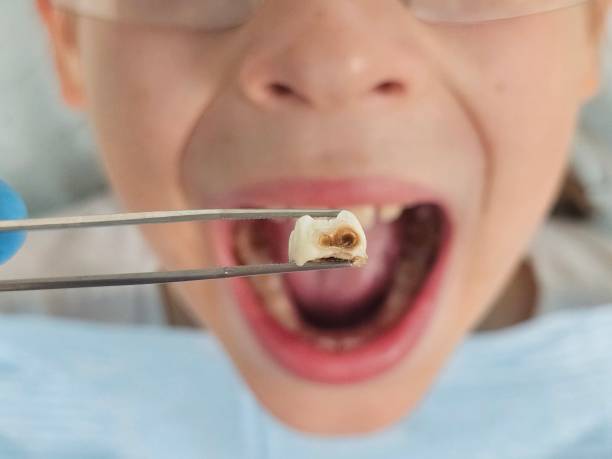 Best Mobile Emergency Dentist in Greencastle, IN