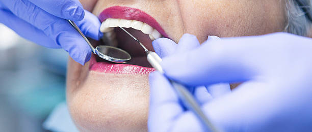 Best Emergency Dental Care for Abscessed Tooth in Greencastle, IN