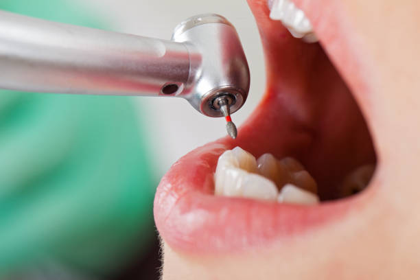 Best Weekend Emergency Dentist in Greencastle, IN